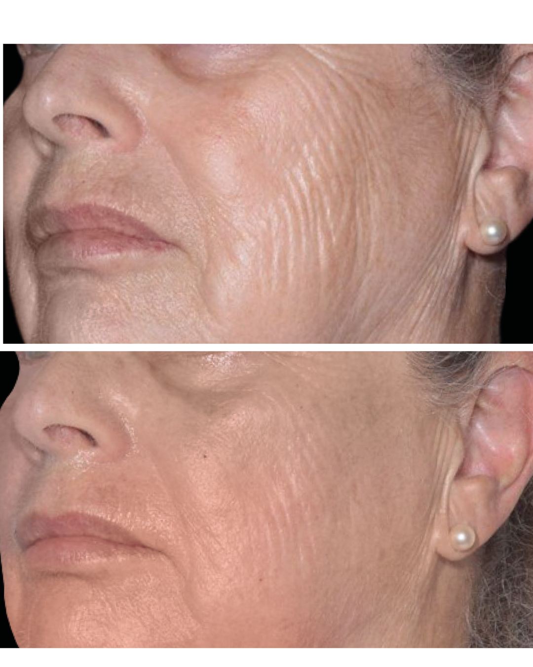 Before and afters (2).png