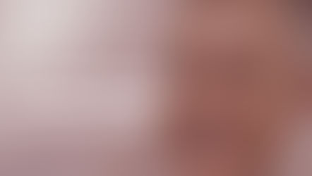 Como conservar um dente avulsionado até o atendimento