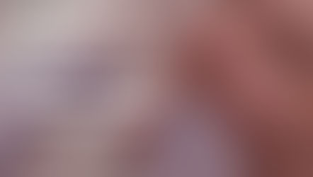 Inchaço na gengiva pode ser perigoso? Entenda os riscos de um abscesso