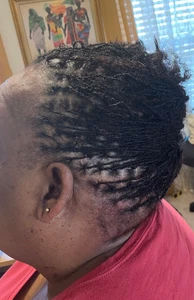Micro-loc extensions