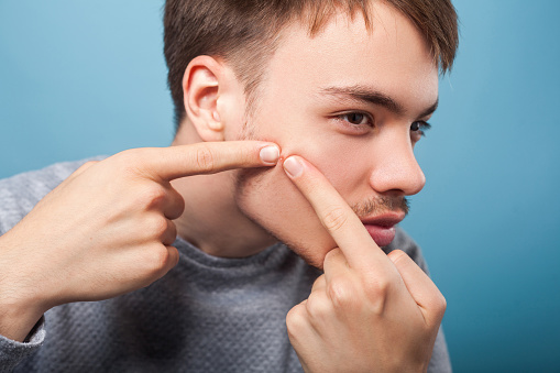 pimples treatment