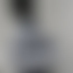 Diagnosis and Management of Focal Nodular Hyperplasia