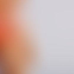 Febuxostat 40 – Uses Side-Effect and Dosage