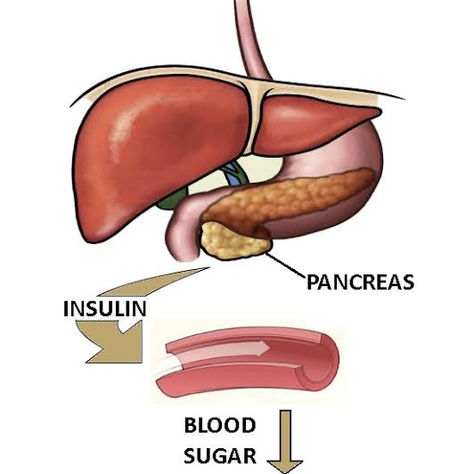 Type 1 vs Type 2 diabetes