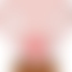 Causes and Treatment of Focal Nodular Hyperplasia