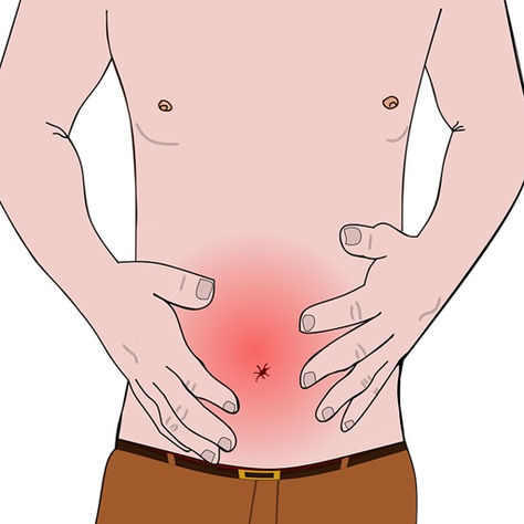 Causes and Treatment of Focal Nodular Hyperplasia