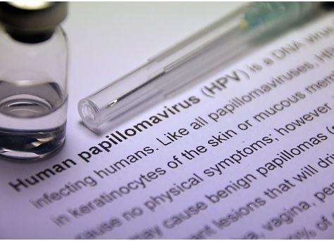 Tree Man Syndrome: A Rare and Deadly Disease