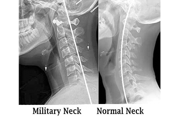 Neutral Neck - 6 hour Workshop