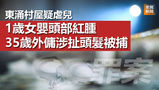 《全民新聞台》［港聞］東涌村屋疑虐兒　1歲女嬰頭部紅腫　35歲外傭涉扯頭髮被捕