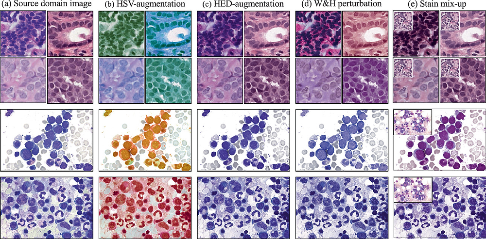 Generalized Staining Stain Mix-Up: Unsupervised Domain Generalization for Histopathology Images