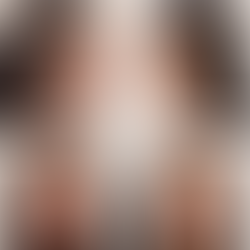 La Importancia de la Proporción Facial en la Rinoplastia: Claves para Resultados Naturales