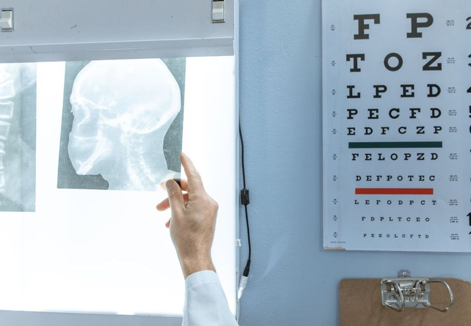 Image of a sunny California beach with sunglasses and an eye exam chart