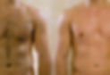 Chest and Back Waxing