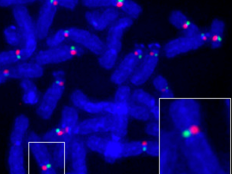 Integrity of the human centromere DNA repeats is protected by CENP-A, CENP-C, and CENP-T