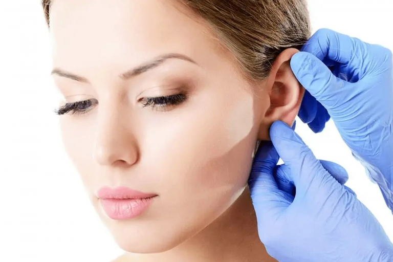 Kepçe Kulak (Otoplasti) Ameliyatı.png