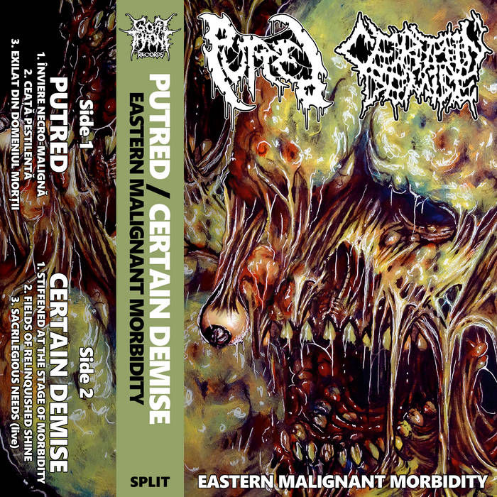 Eastern Malignant Morbidity Split