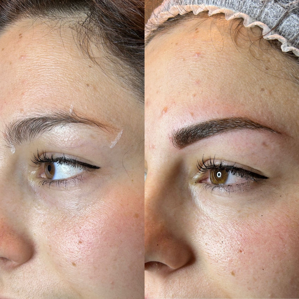profils dermopigmentation