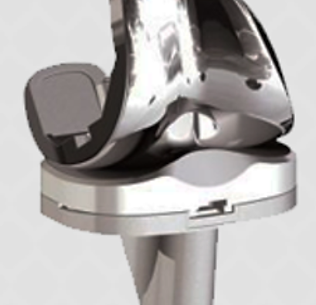 Artroplastia do Joelho (Prótese do Joelho).png