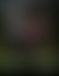 WHY ACL RETURN TO PLAY IS MORE THAN A TIMELINE