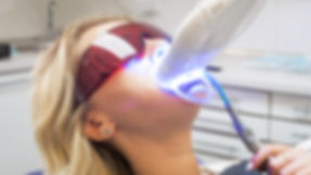 Teeth Whitening Image.jpeg