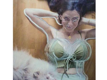 Botox Risks in the Age of Algorithmic Beauty