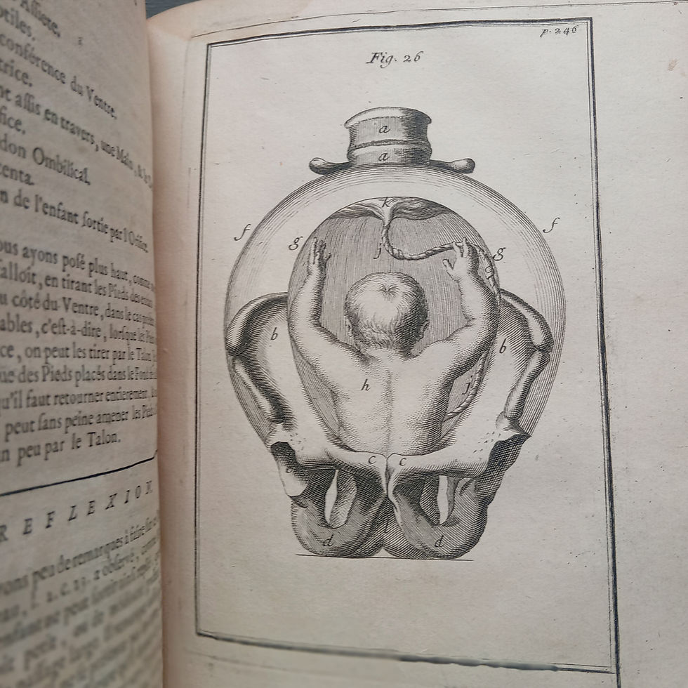 Miniature : « Observations importantes sur le Manuel des Accouchemens »