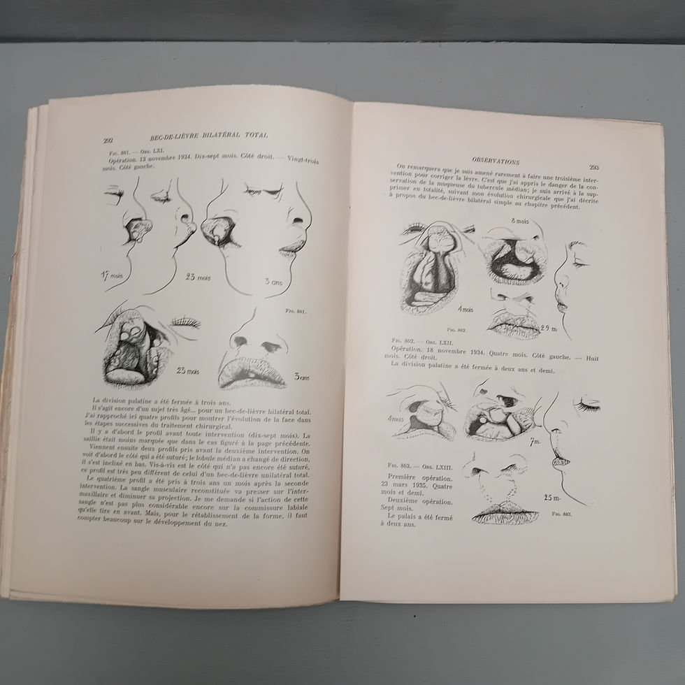 Thumbnail: VEAU Victor « Bec-de-Lièvre. Formes cliniques – Chirurgie »