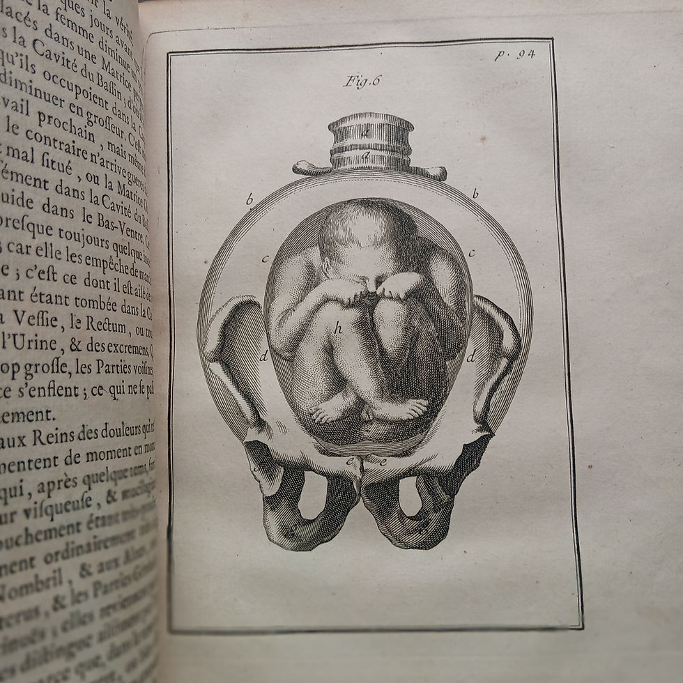 Miniature : « Observations importantes sur le Manuel des Accouchemens »