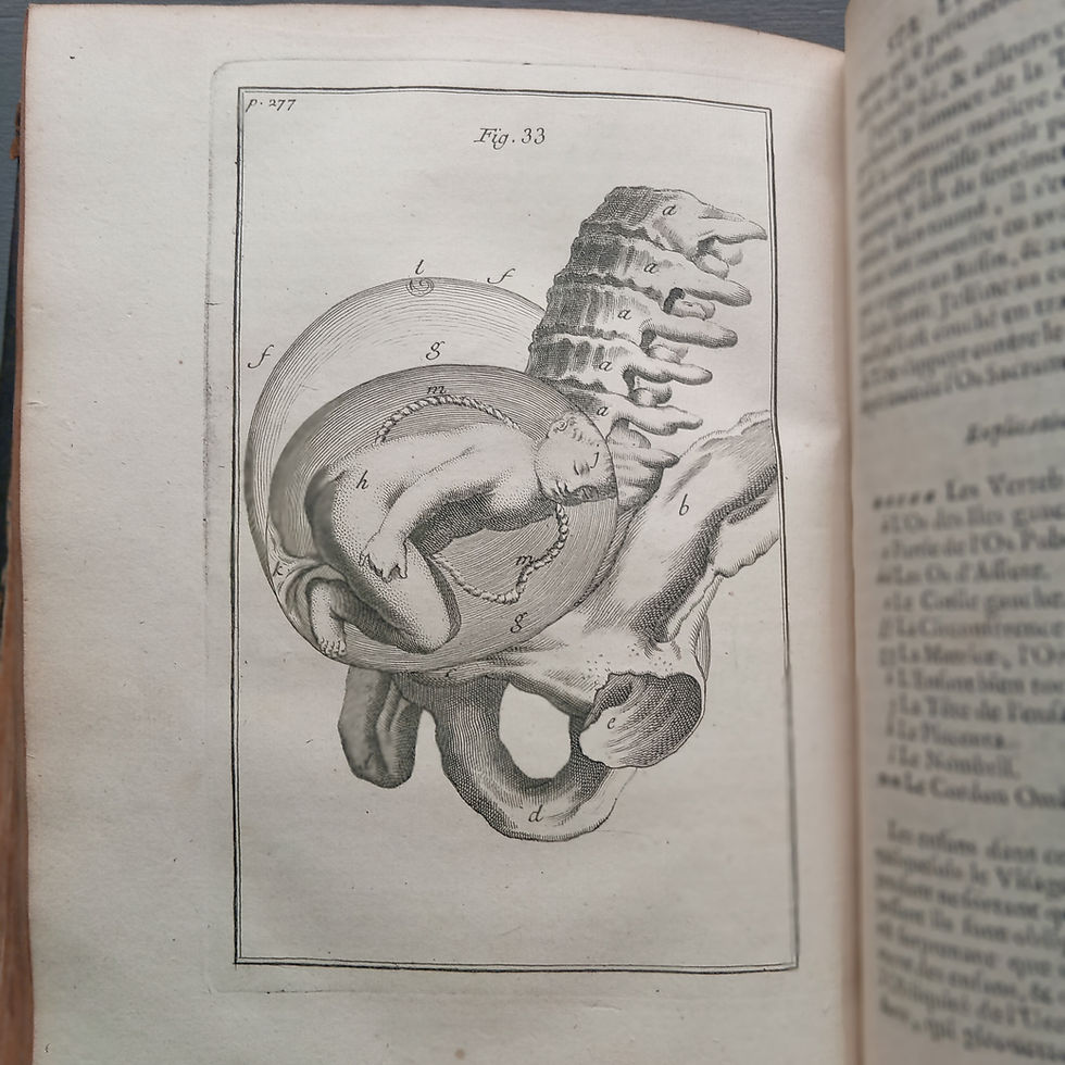 Miniature : « Observations importantes sur le Manuel des Accouchemens »