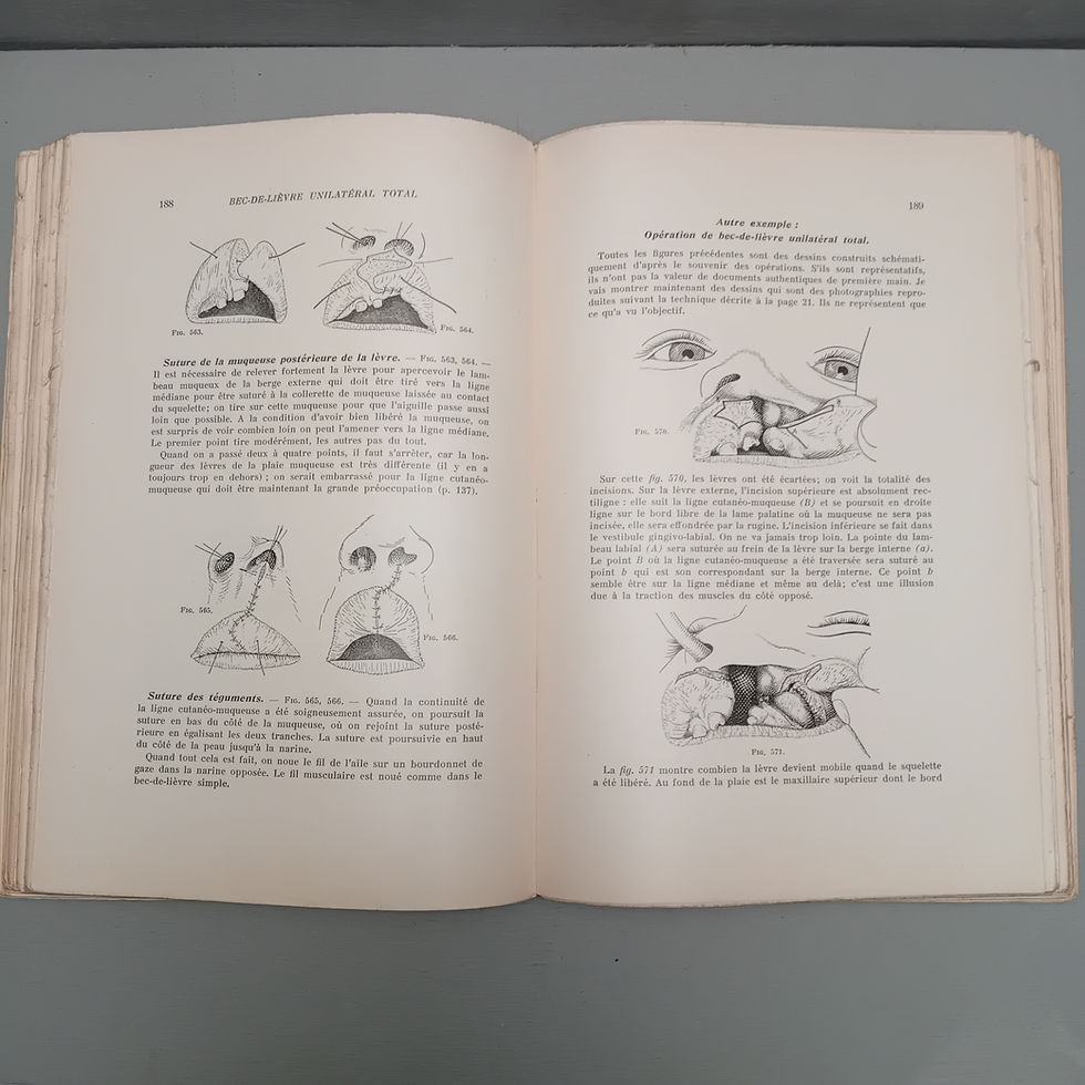Miniature : VEAU Victor « Bec-de-Lièvre. Formes cliniques – Chirurgie »