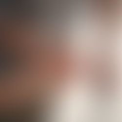 Finalmente un sollievo per l'artrosi alle mani: un farmaco già in commercio promette di sconfiggere il dolore.