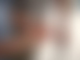 Finalmente un sollievo per l'artrosi alle mani: un farmaco già in commercio promette di sconfiggere il dolore.