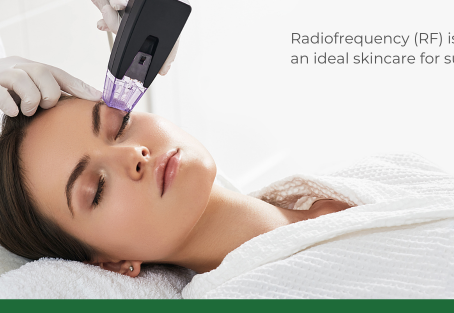 Summer Is The Perfect Timing For Radiofrequency On Your Skin