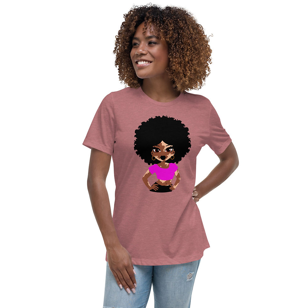 Thumbnail: Vitiligo Woman with Pink Shirt Women's Relaxed T-Shirt