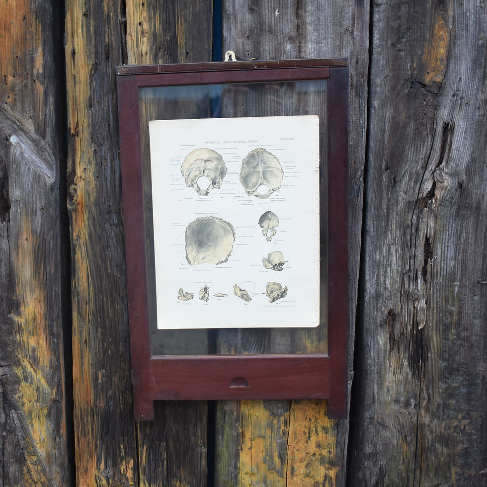 Thumbnail: Antique Anatomical Skull Print 1885 W & AK Johnston Mahogany Museum Framed Plate