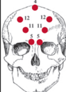 points neuro vasculaire