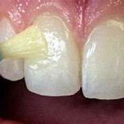 a visual of preventive dentistry