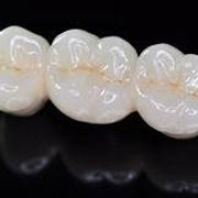 visual of dental crowns and bridges