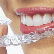 a visual of dental aligners/invisible braces