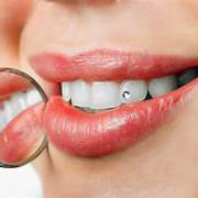 a visual of tooth jewelry