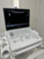 Ultrassom com tecnologia de ponta na Recife Saúde em Casa Amarela