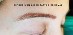 red eyebrows before tattoo ramoval