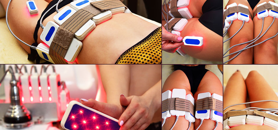 lipo laser. Hardware cosmetology. Body care. Non surgical body sculpting. body contouring