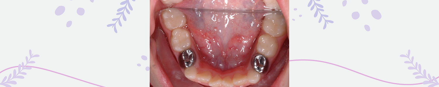 n the realm of paediatric dentistry, Studio Aesthetique is dedicated to providing specialized and compassionate care
