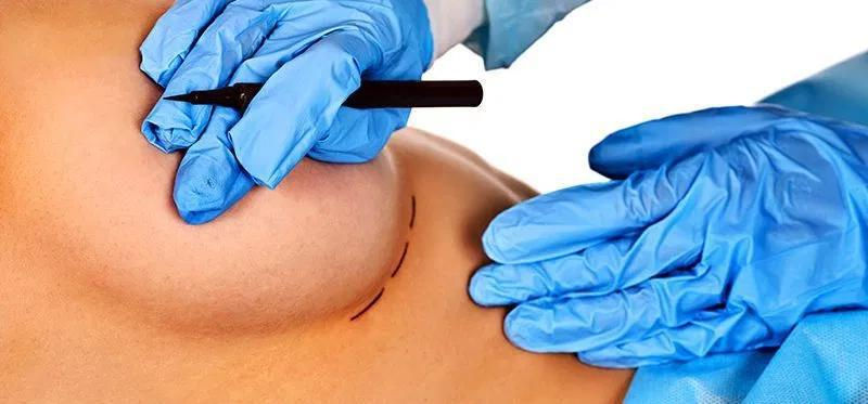 Direito do paciente: a cirurgia plástica reparadora no ordenamento jurídico brasileiro