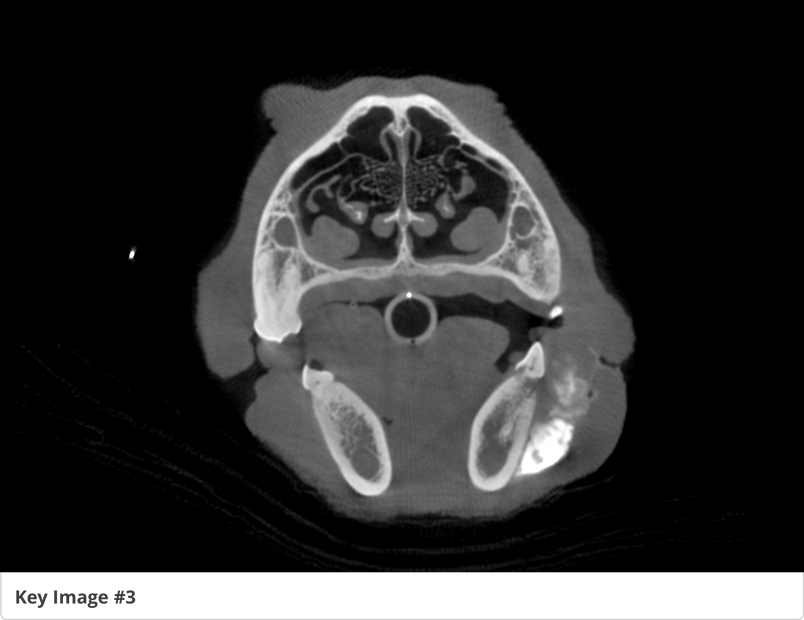 Draining lymphnode.png