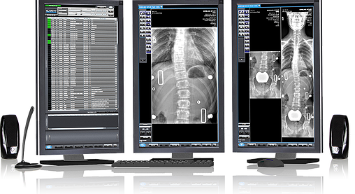 free dicom viewer mammo free dicom viewer mammo