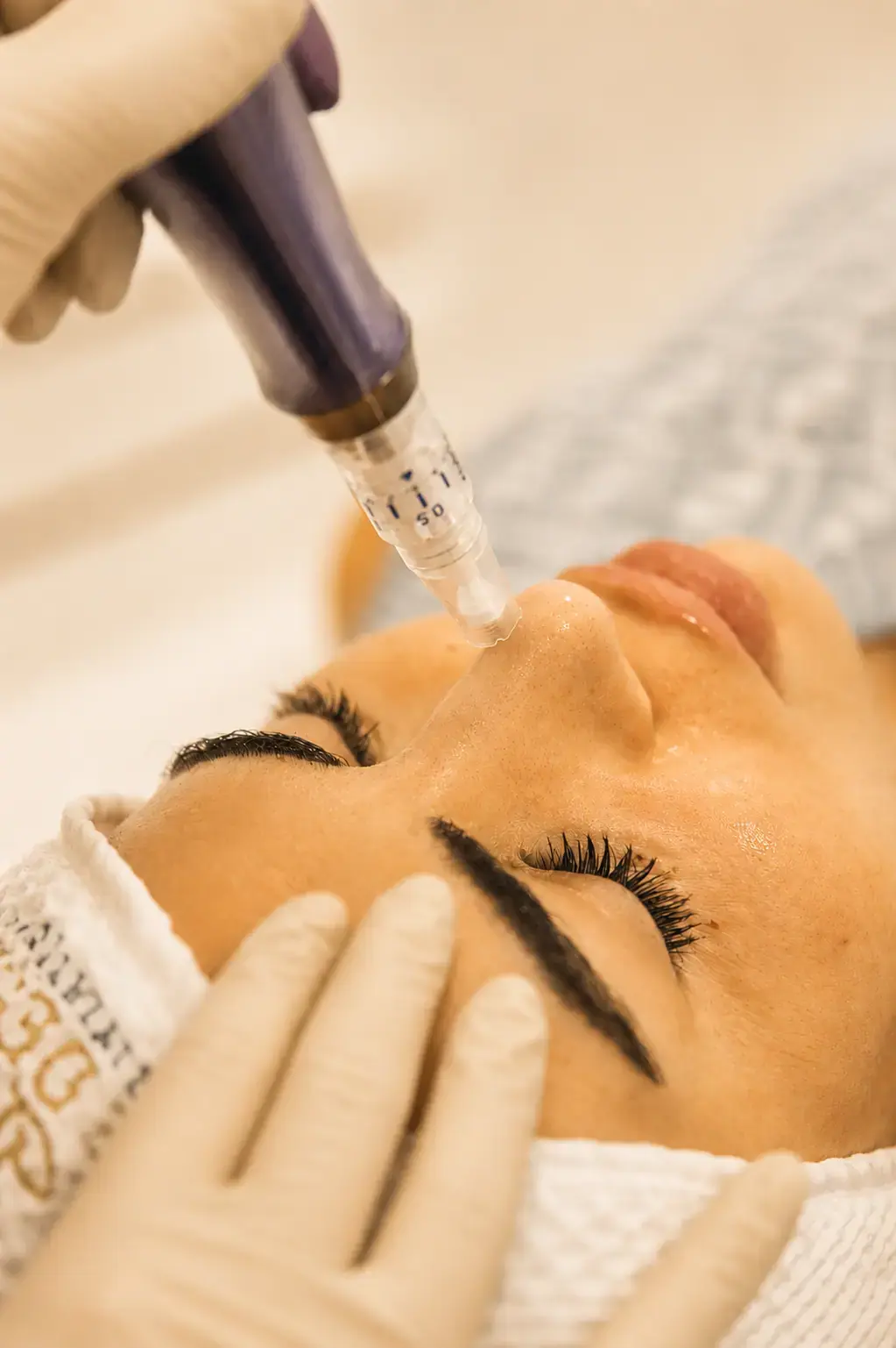 prp mesotherapy dubai