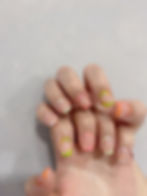 Shellac