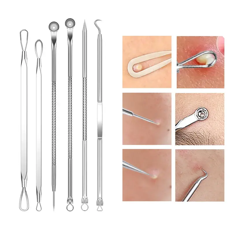 Thumbnail: 4-11Pcs Ingrown Hair Tweezers Acne Blackhead Removal Needles Black Dots Cleaner 